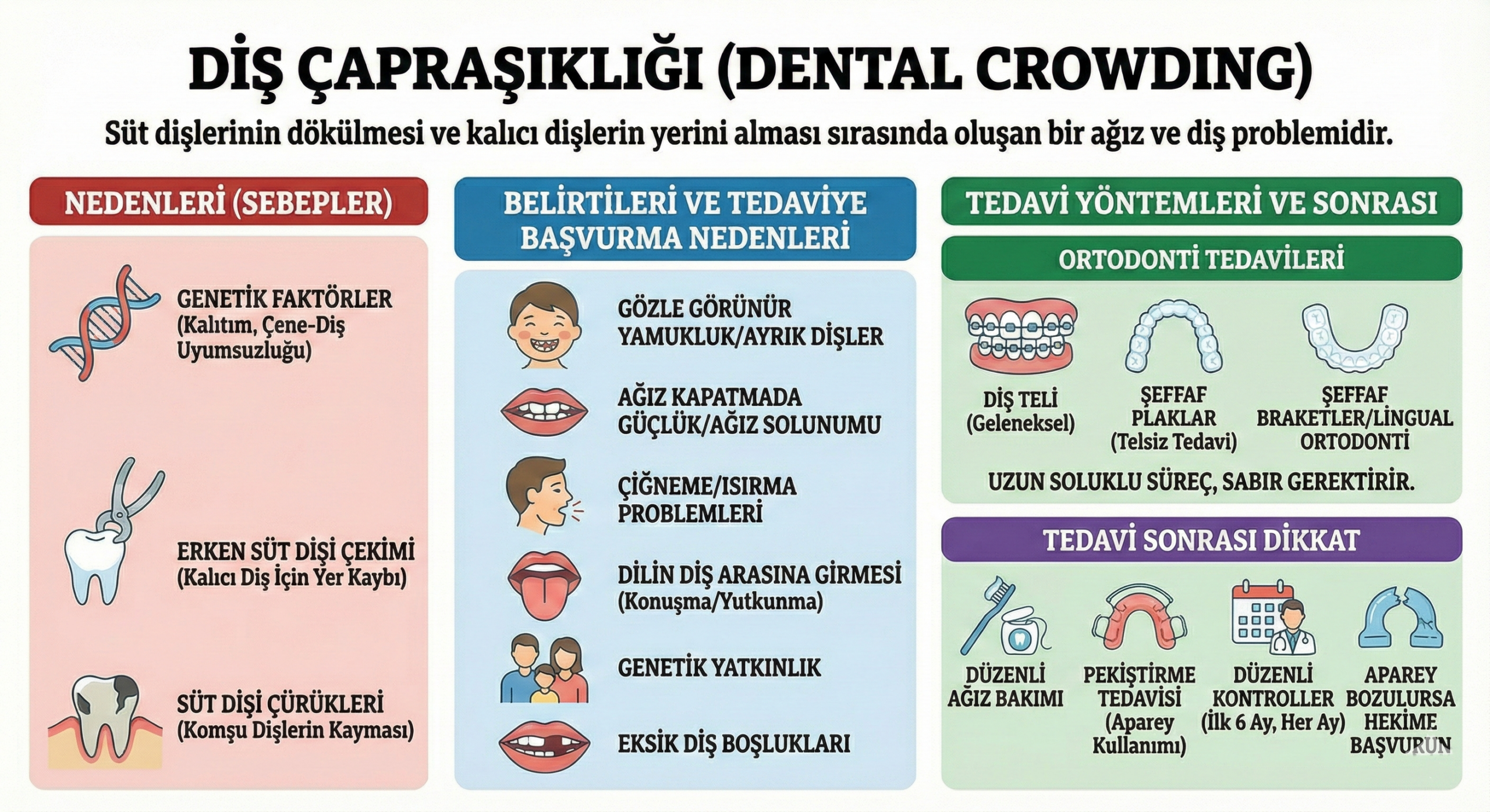 Diş Çapraşıklığı