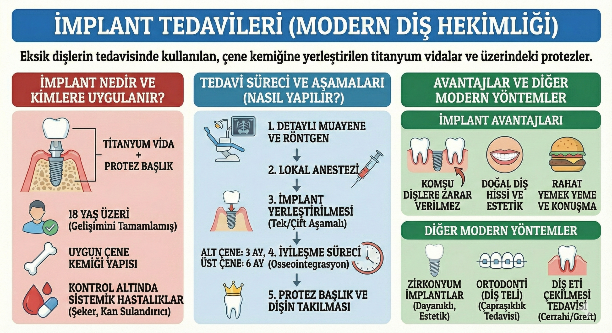 İmplant Tedavileri
